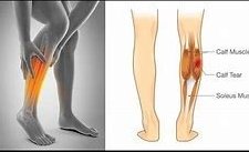 É normal sentir cãibra na perna? Veja as causas e como prevenir!