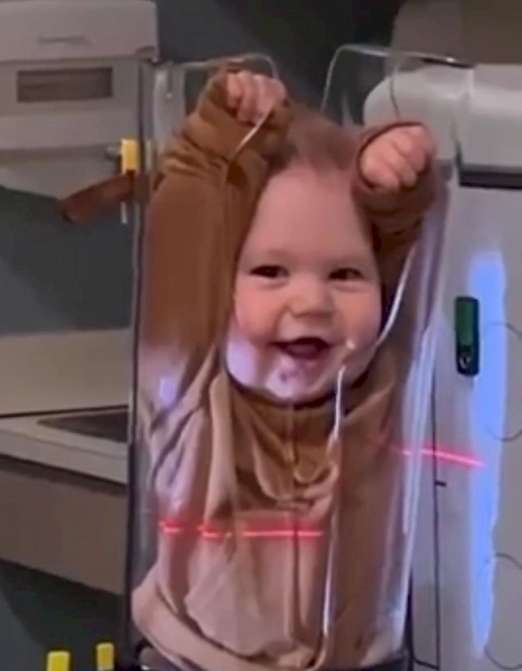 Bebê Viraliza em Vídeo de Raio-x