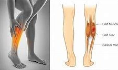 É normal sentir cãibra na perna? Veja as causas e como prevenir!